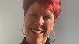De duimbasisartrose van mevrouw Nijhof