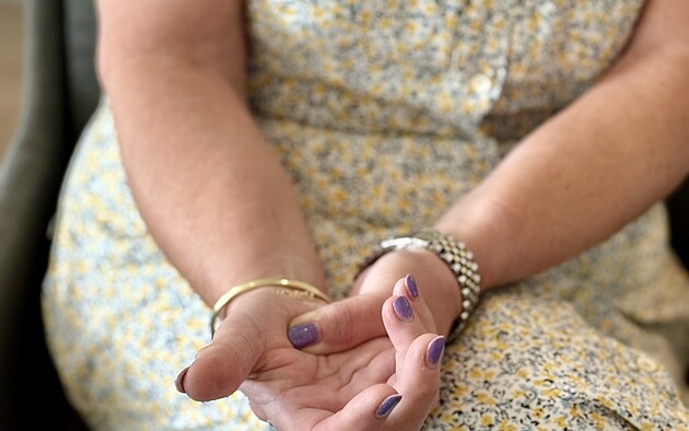 De pols fractuur van mevr. van Zijl